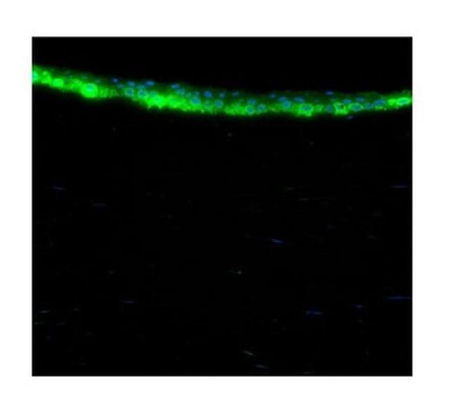 ALDH3A1 Antibody in Immunohistochemistry (IHC)