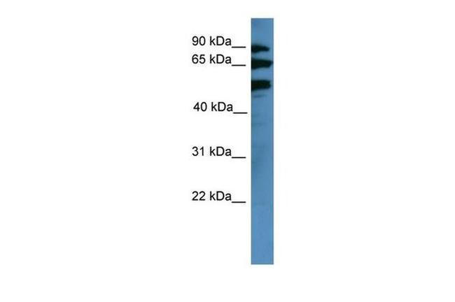 BBS2 Antibody in Western Blot (WB)