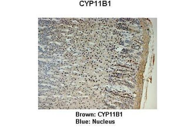 CYP11B1 Antibody in Immunohistochemistry (IHC)