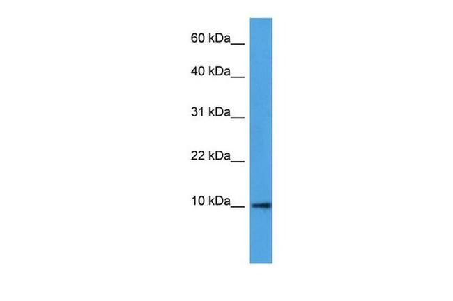 beta-2 Defensin Antibody in Western Blot (WB)