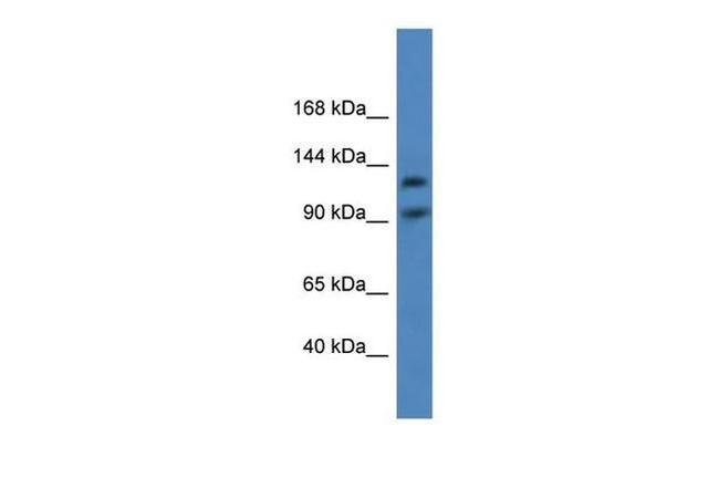 LONP2 Antibody in Western Blot (WB)