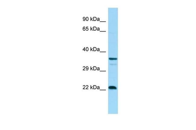 CD83 Antibody in Western Blot (WB)