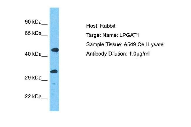 LPGAT1 Antibody in Western Blot (WB)