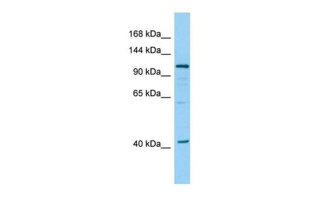 DHTKD1 Antibody in Western Blot (WB)