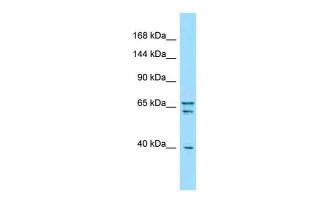 PCLO Antibody in Western Blot (WB)