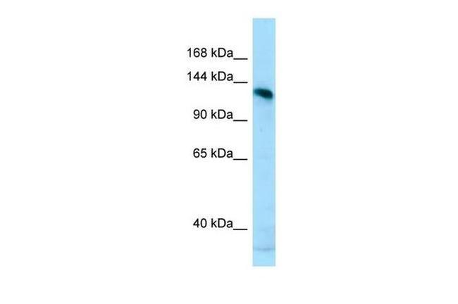 AMPD2 Antibody in Western Blot (WB)