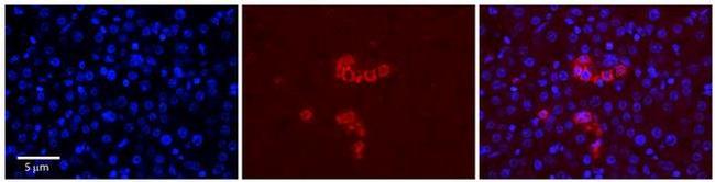 RPS28 Antibody in Immunohistochemistry (Paraffin) (IHC (P))