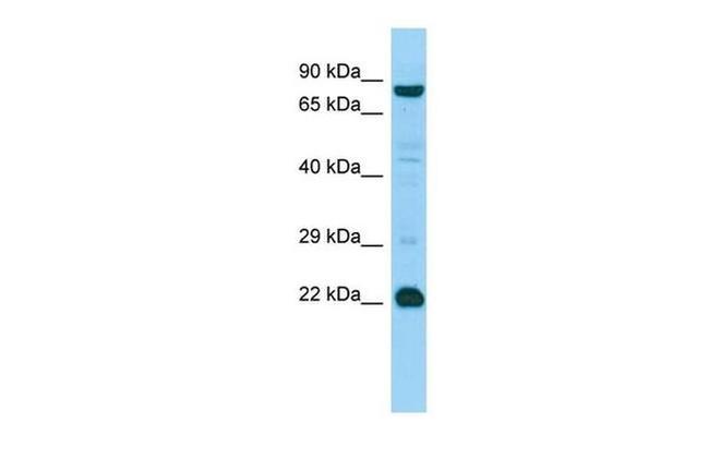 MED22 Antibody in Western Blot (WB)