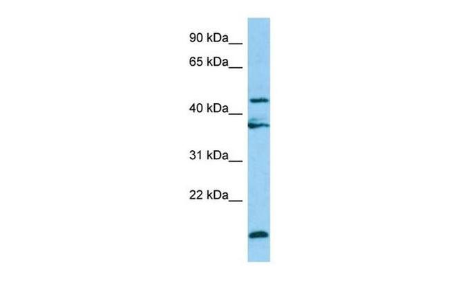 LGMN Antibody in Western Blot (WB)