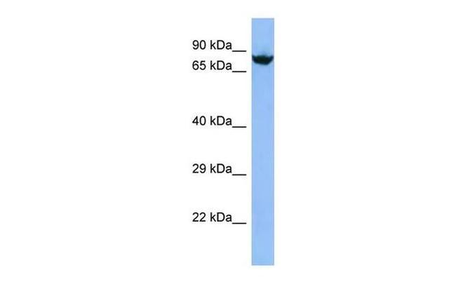 DHX40 Antibody in Western Blot (WB)