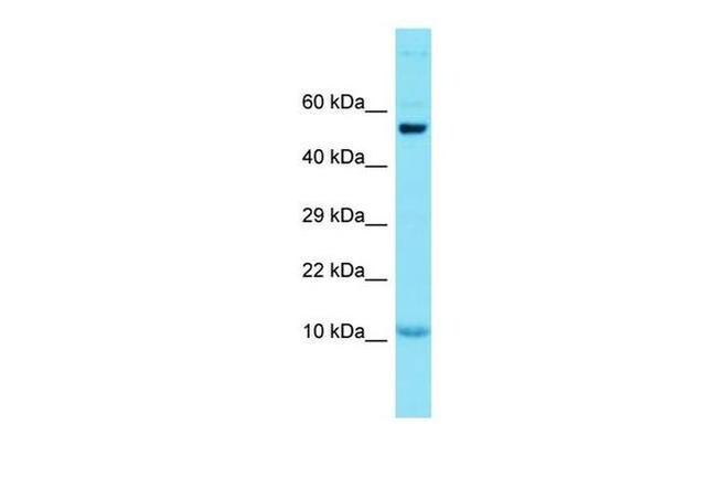 GCSAML Antibody in Western Blot (WB)