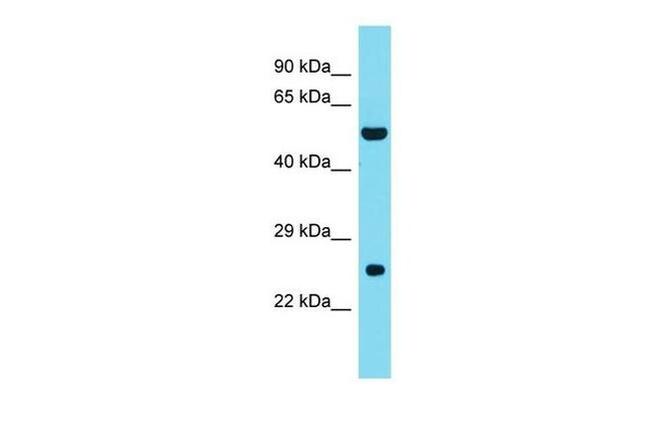 DNAAF3 Antibody in Western Blot (WB)