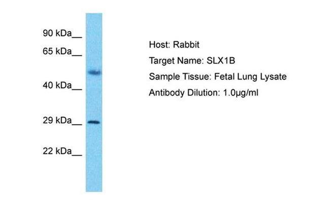 SLX1B Antibody in Western Blot (WB)