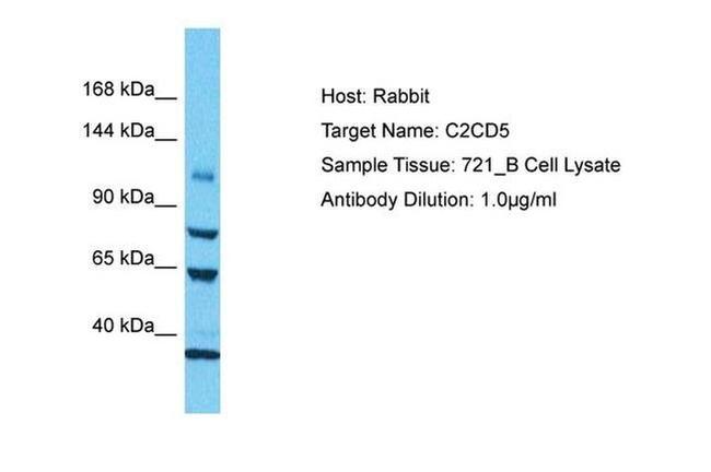 C2CD5 Antibody in Western Blot (WB)