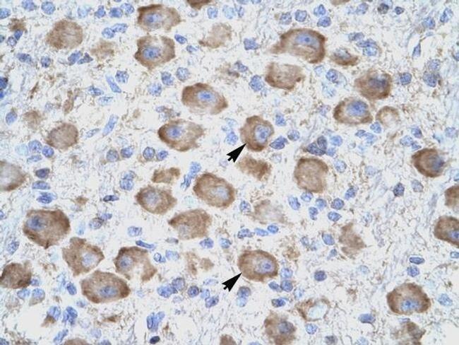 CD357 (AITR/GITR) Antibody in Immunohistochemistry (IHC)