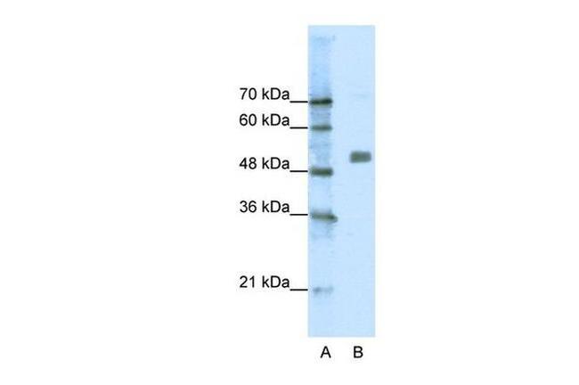 CHRNA9 Antibody in Western Blot (WB)