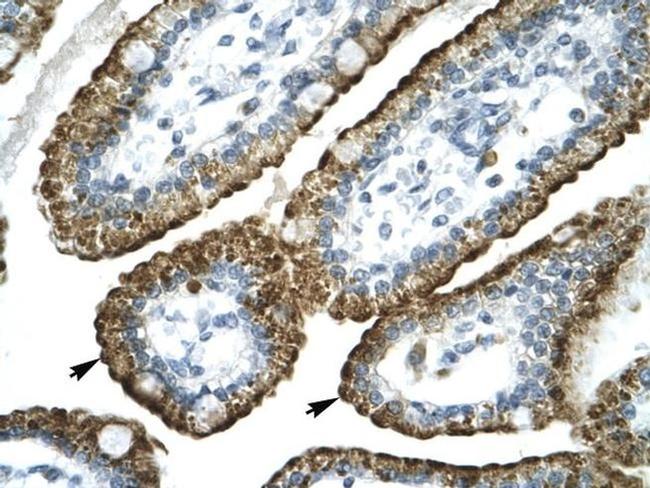 GABRP Antibody in Immunohistochemistry (Paraffin) (IHC (P))