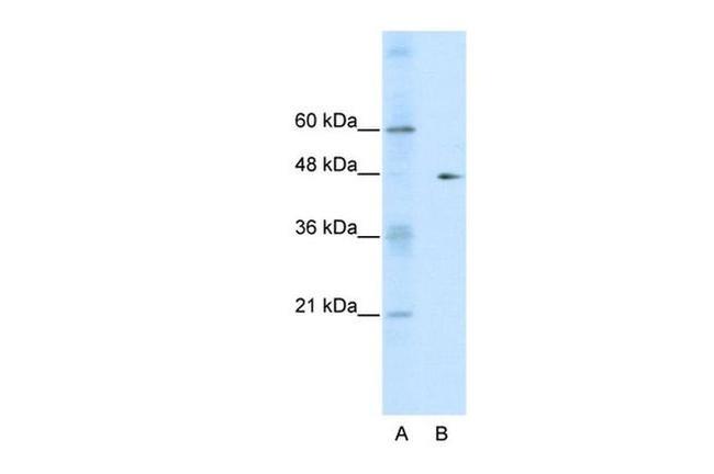 GDI2 Antibody in Western Blot (WB)