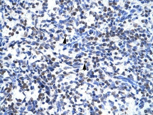 GCM1 Antibody in Immunohistochemistry (IHC)