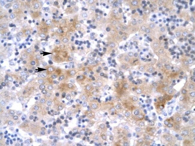 LIM1 Antibody in Immunohistochemistry (IHC)