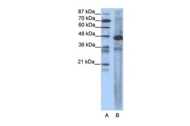 SRF Antibody in Western Blot (WB)