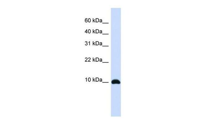 ID1 Antibody in Western Blot (WB)