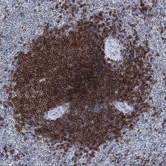 CD268 (BAFF Receptor) Antibody in Immunohistochemistry (Paraffin) (IHC (P))