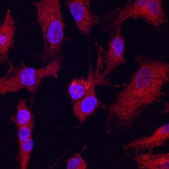 hCV-2 Antibody in Immunocytochemistry (ICC/IF)