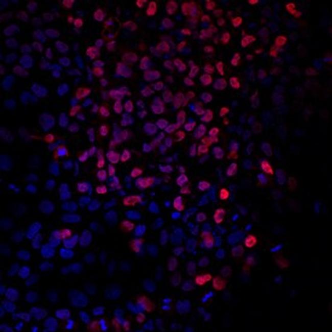 Brachyury Antibody in Immunocytochemistry (ICC/IF)