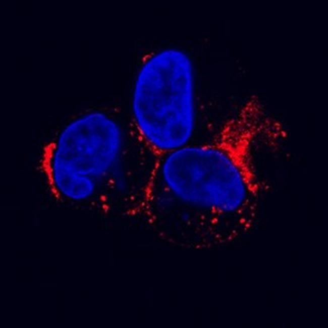 LDLR Antibody in Immunocytochemistry (ICC/IF)