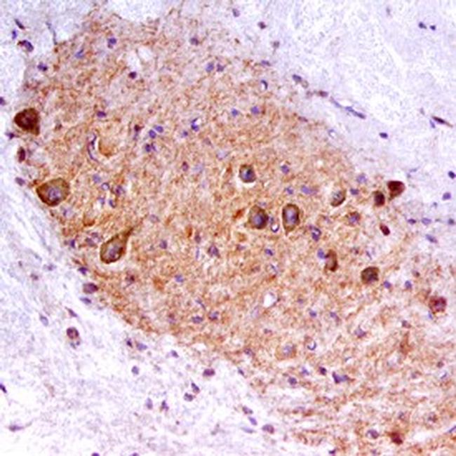 RET Antibody in Immunohistochemistry (Frozen) (IHC (F))