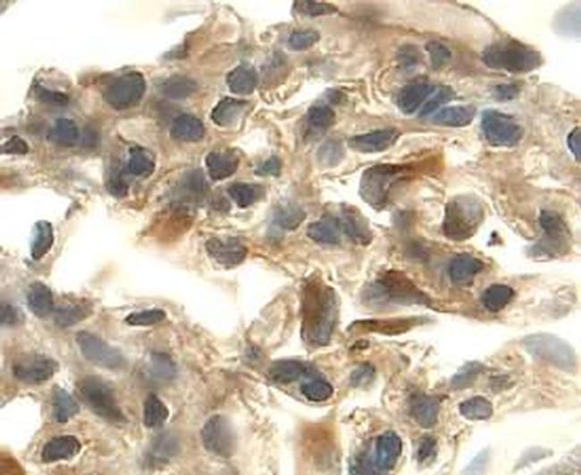 VEGF-164 Antibody in Immunohistochemistry (Frozen) (IHC (F))