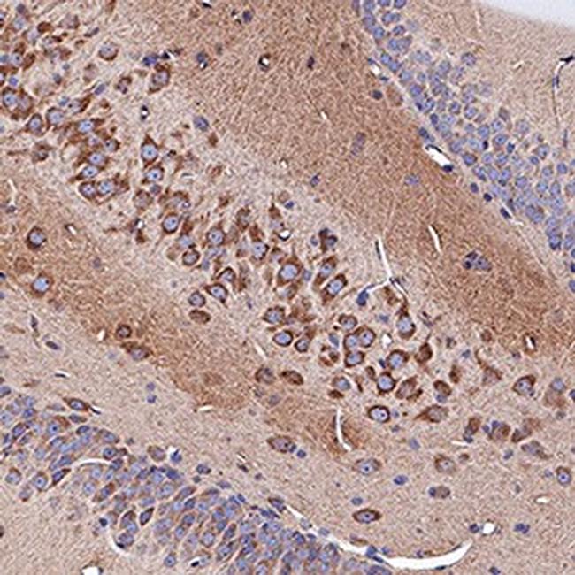 Neuropilin 1 Antibody in Immunohistochemistry (Paraffin) (IHC (P))