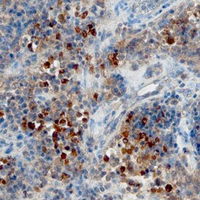 CXCL13 Antibody in Immunohistochemistry (Paraffin) (IHC (P))