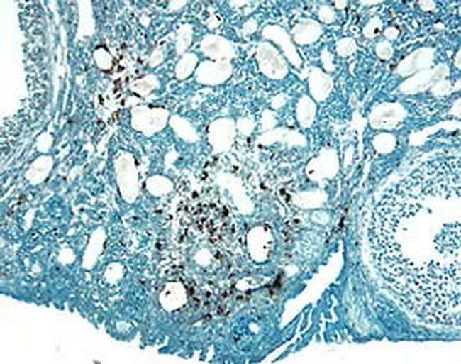 Cathepsin H Antibody in Immunohistochemistry (Frozen) (IHC (F))