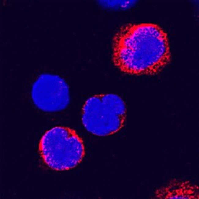 ADAM8 Antibody in Immunocytochemistry (ICC/IF)