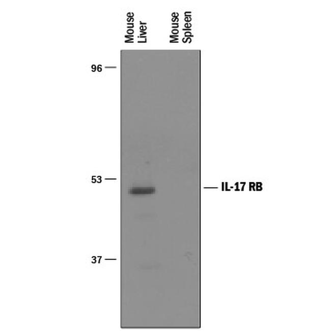 IL17RB Antibody in Western Blot (WB)