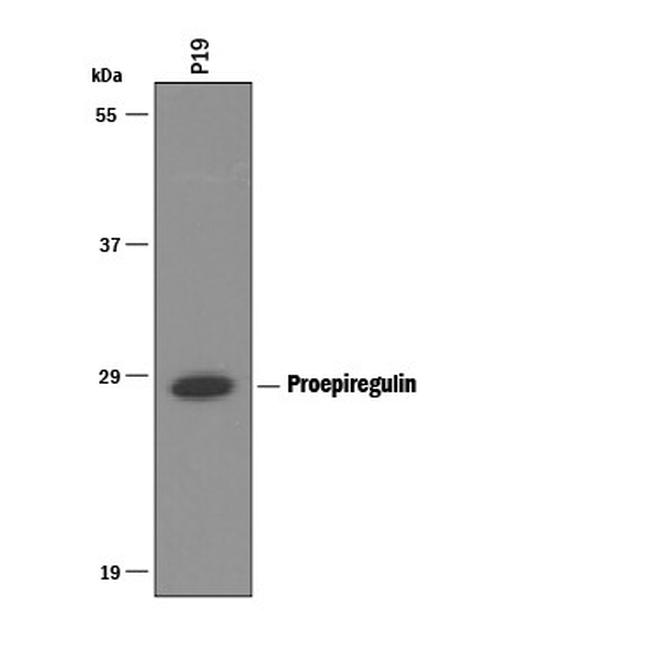 Epiregulin Antibody in Western Blot (WB)