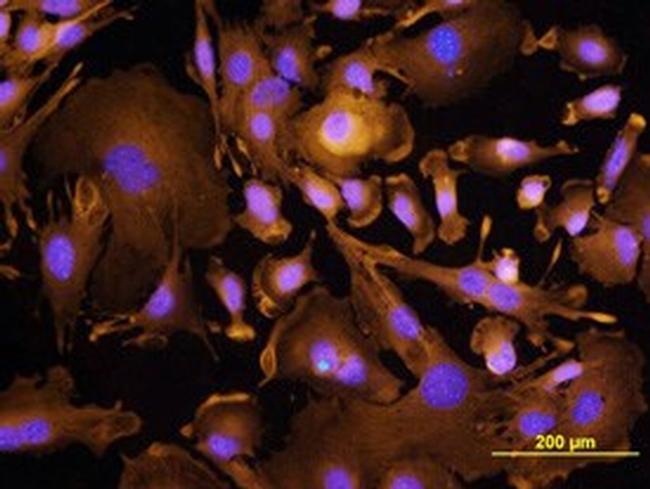 TROP2 Antibody in Immunocytochemistry (ICC/IF)