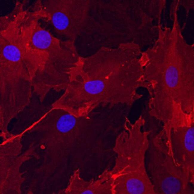 CD166 Antibody in Immunocytochemistry (ICC/IF)