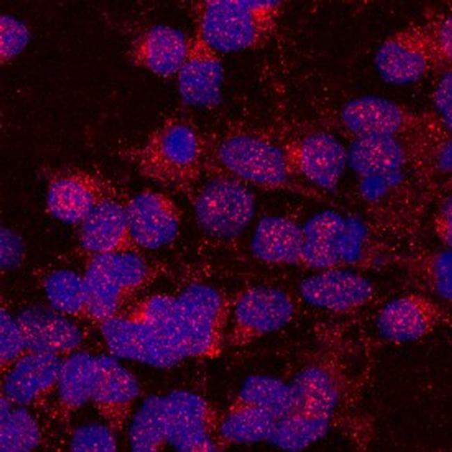 UNC5A Antibody in Immunocytochemistry (ICC/IF)