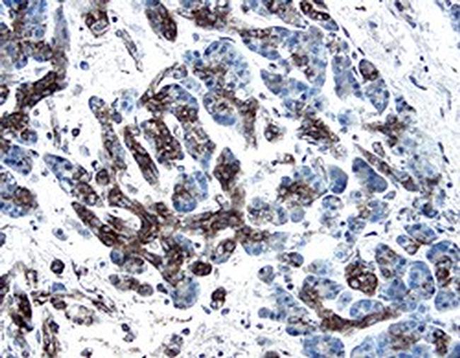 PDGF-C Antibody in Immunohistochemistry (Paraffin) (IHC (P))