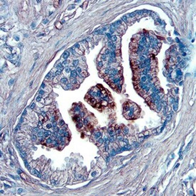 NOV Antibody in Immunohistochemistry (Paraffin) (IHC (P))