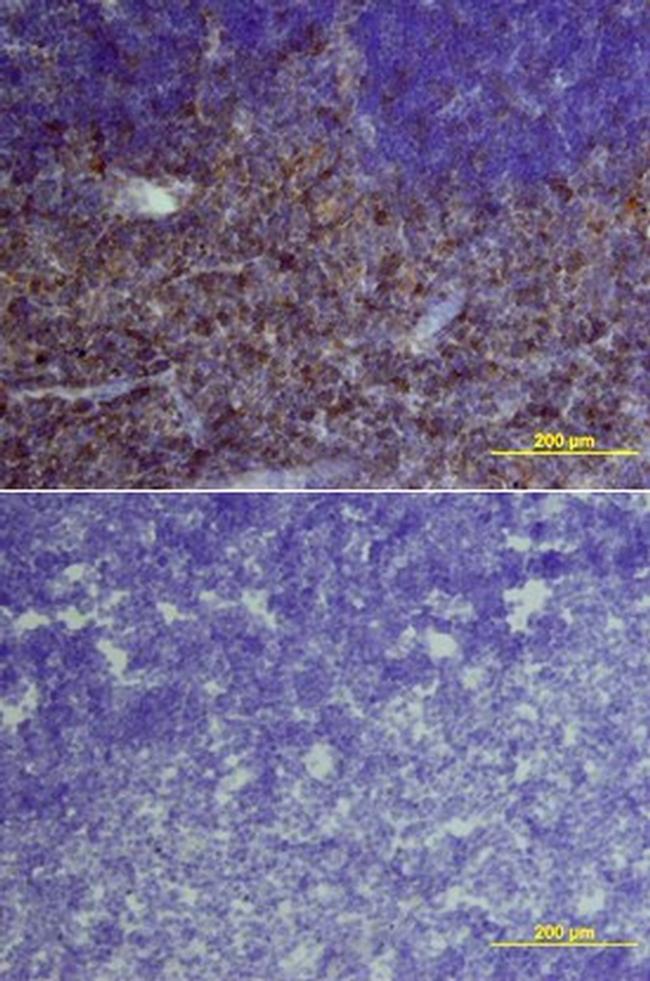 IL-6 Receptor Antibody in Immunohistochemistry (Frozen) (IHC (F))