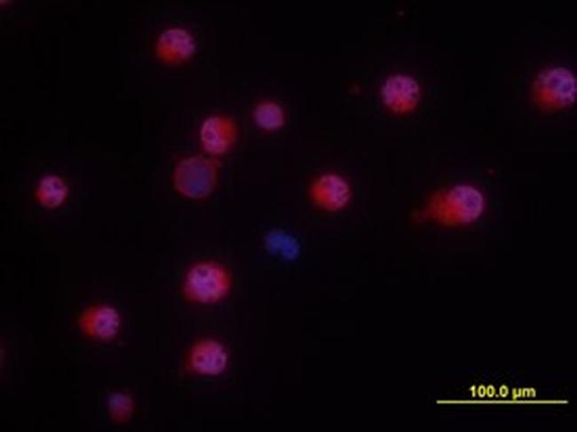 NKp46 Antibody in Immunocytochemistry (ICC/IF)