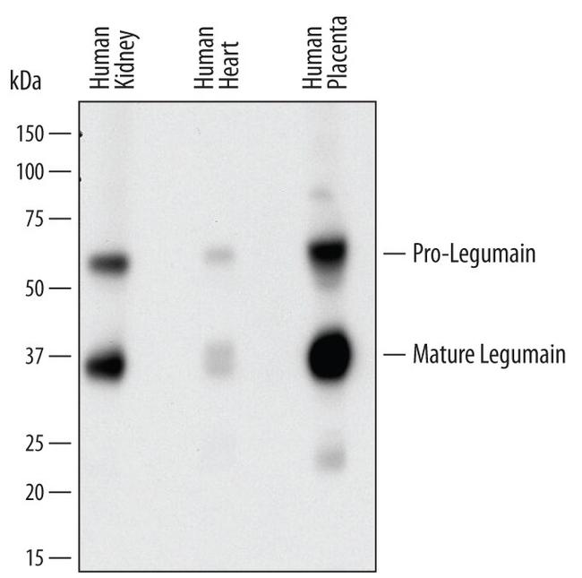 LGMN Antibody in Western Blot (WB)