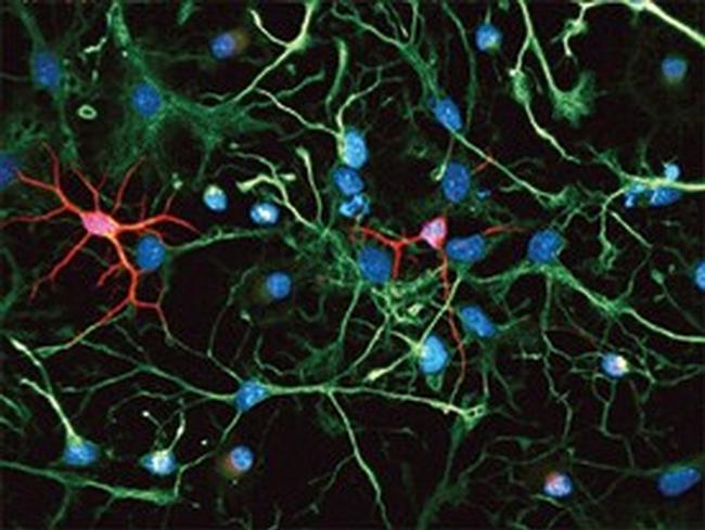 Nestin Antibody in Immunocytochemistry (ICC/IF)