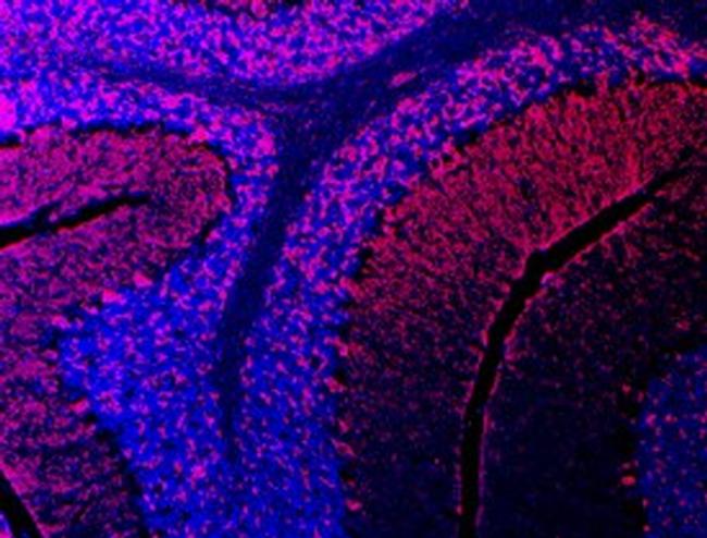 SEMA3E Antibody in Immunohistochemistry (Frozen) (IHC (F))