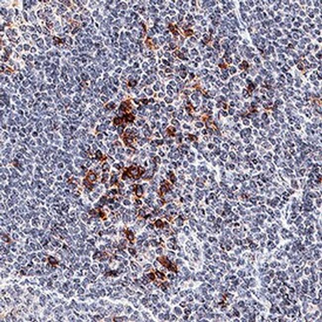 OX40 Antibody in Immunohistochemistry (Paraffin) (IHC (P))