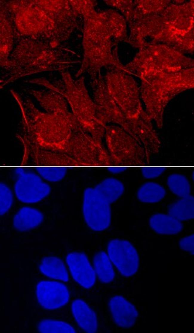 Carboxypeptidase E Antibody in Immunocytochemistry (ICC/IF)